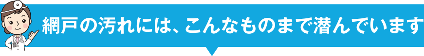網戸の汚れ…こんなお悩みありませんか